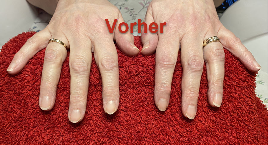 Vorher